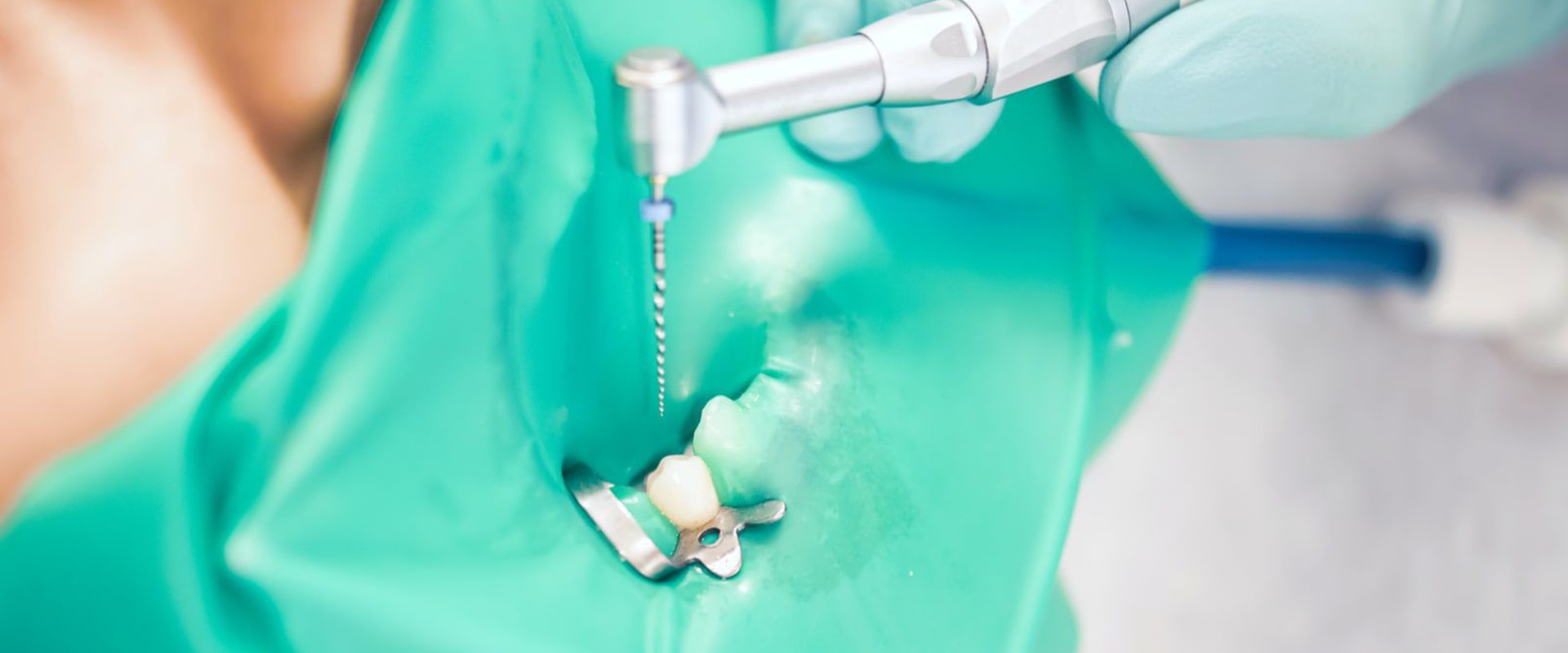 Why see an endodontist?