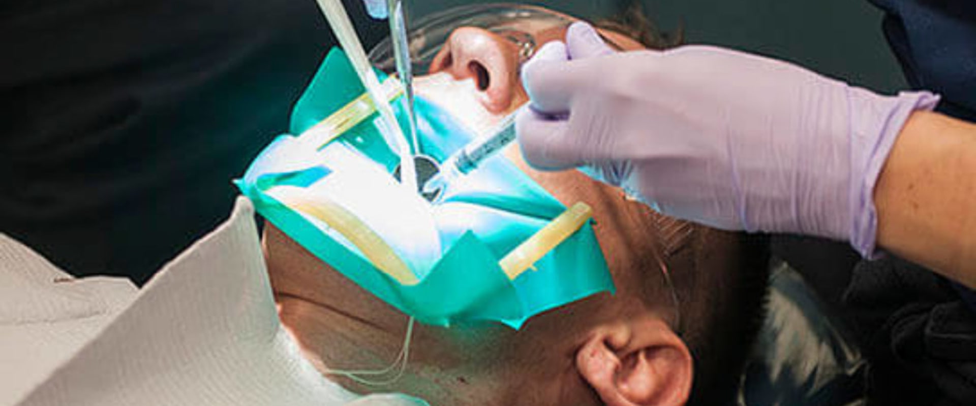 Why Should You See an Endodontist?