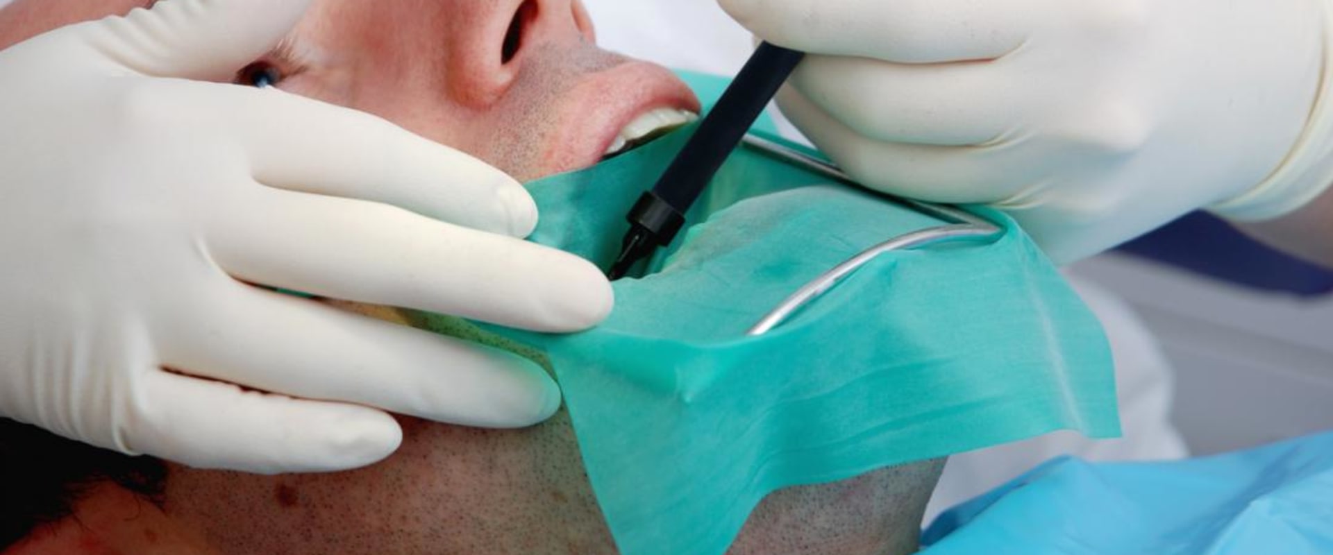 Can endodontist pull teeth?