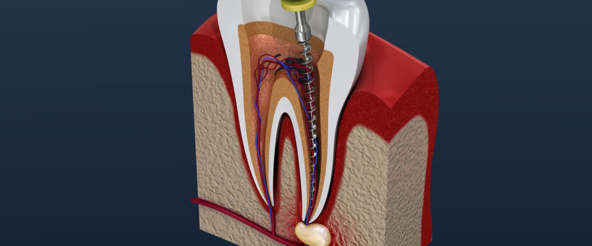 What is an Endodontist? A Comprehensive Guide