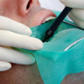 What do endodontists treat?