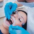 Do Endodontists Accept Medical Insurance?