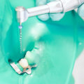 Why You Should See an Endodontist