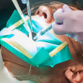 Why Should You See an Endodontist?