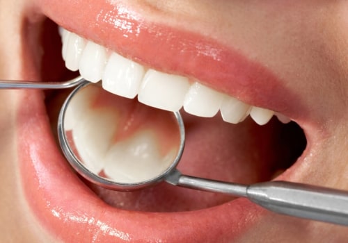 Why did you choose endodontics?